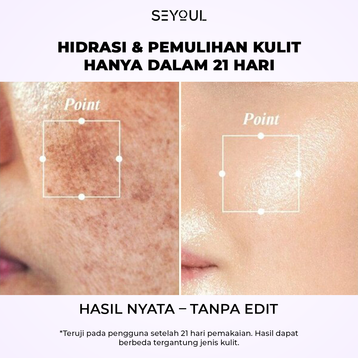 Serum 21 Days Remould Youth SEYOUL