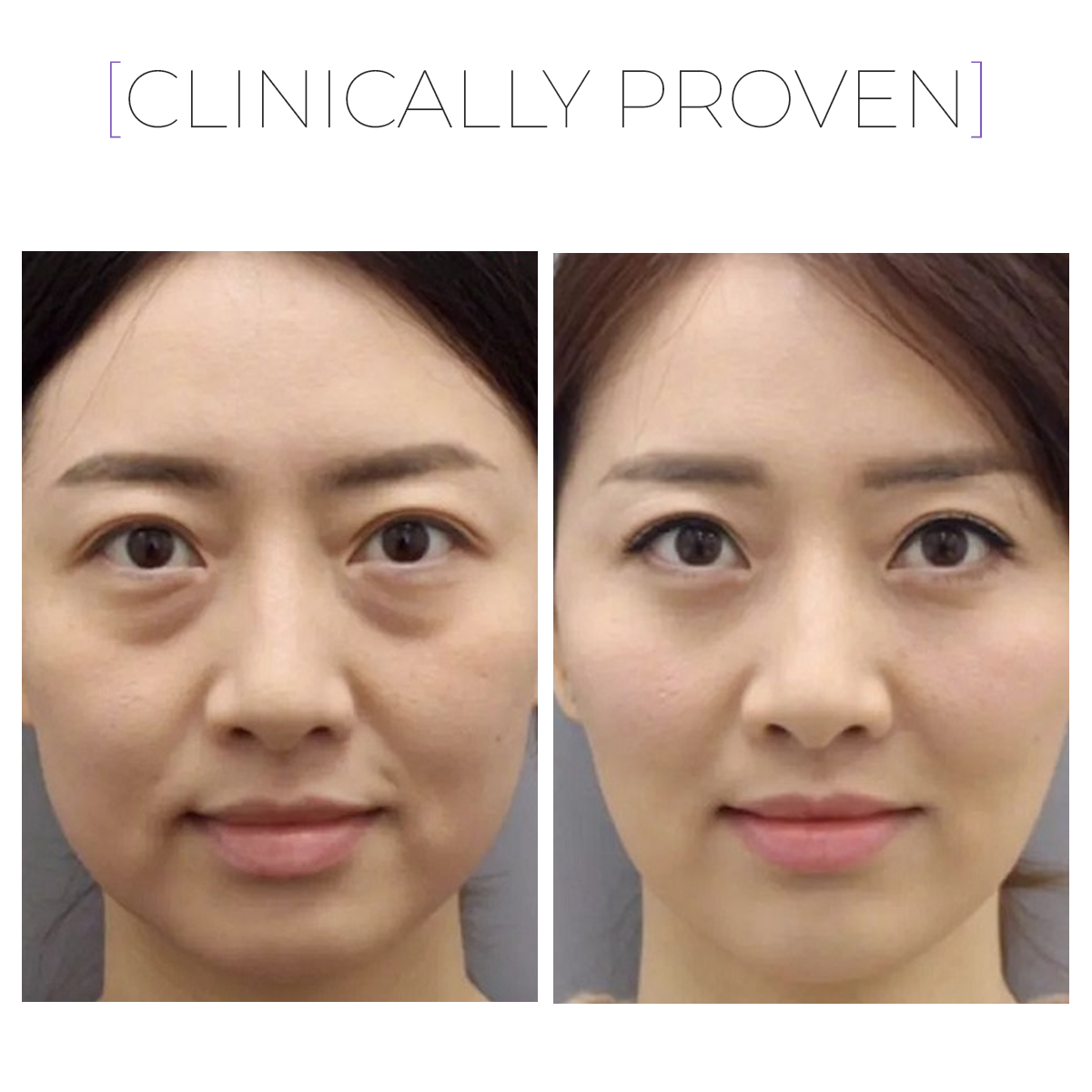 Paket GLOW Recovery Trio