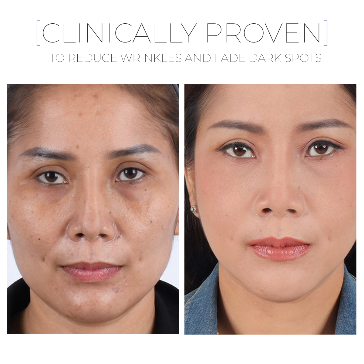 Paket GLOW Recovery Trio