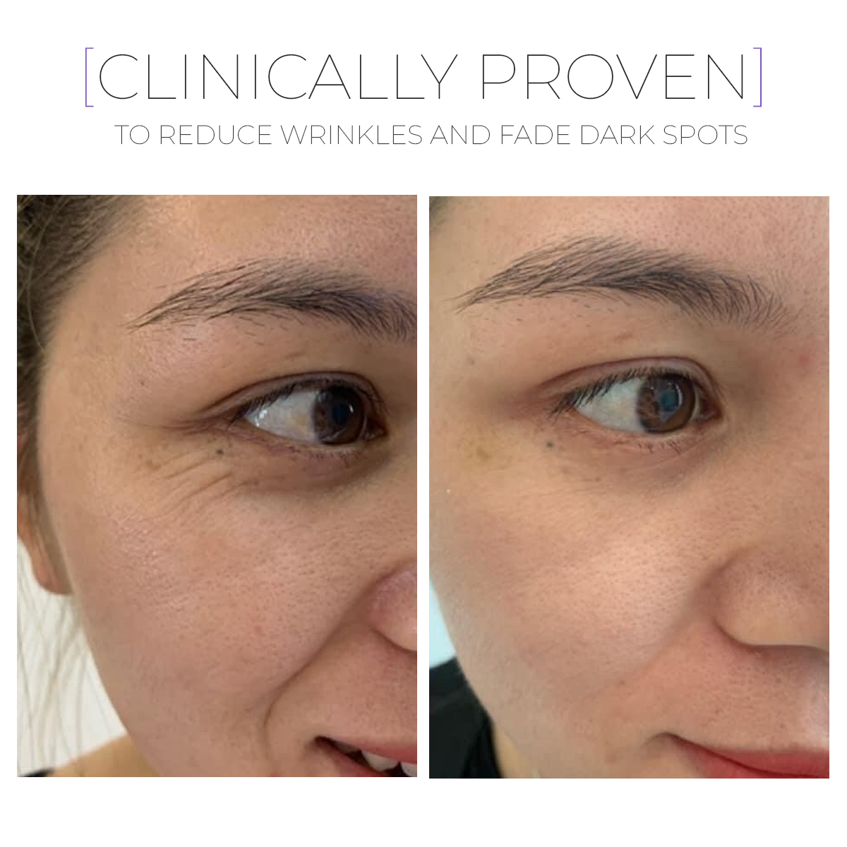 Paket GLOW Recovery Trio