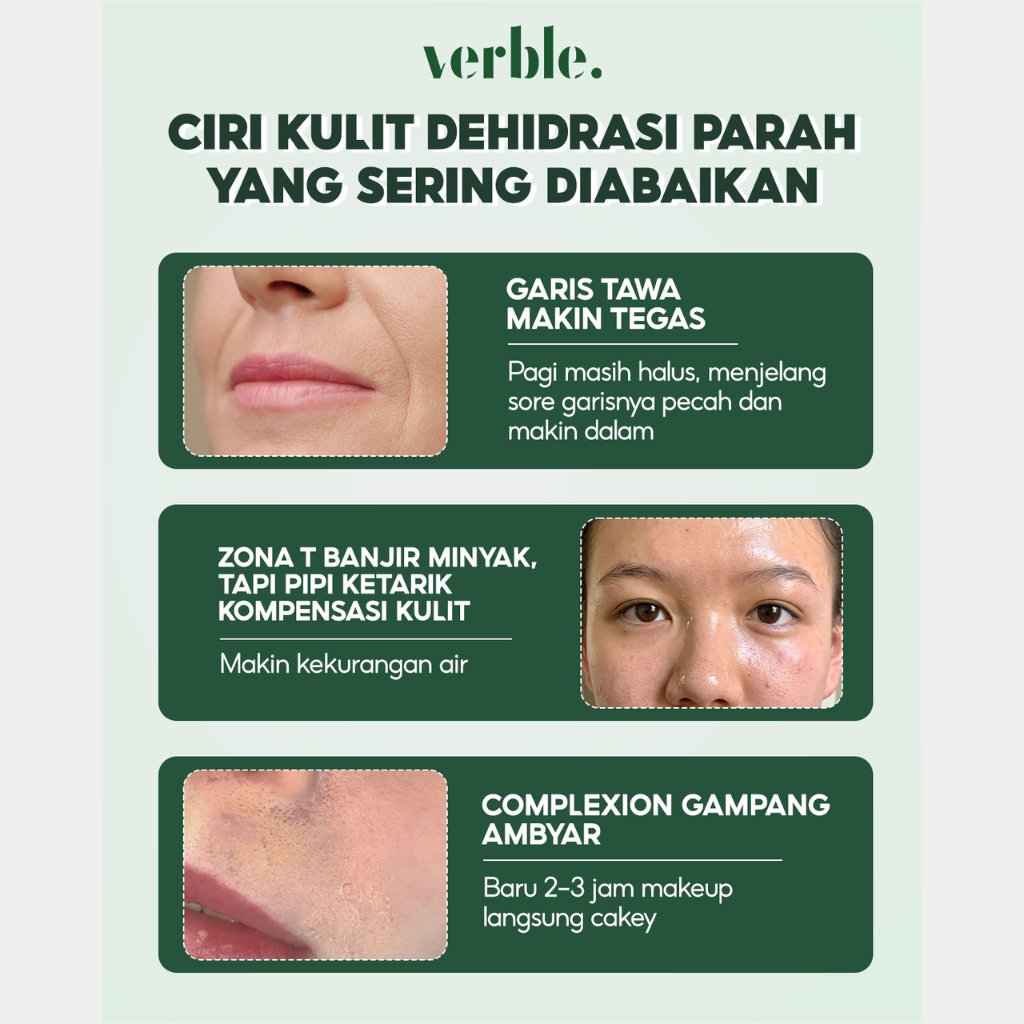 Hydra Dew Serum Verble