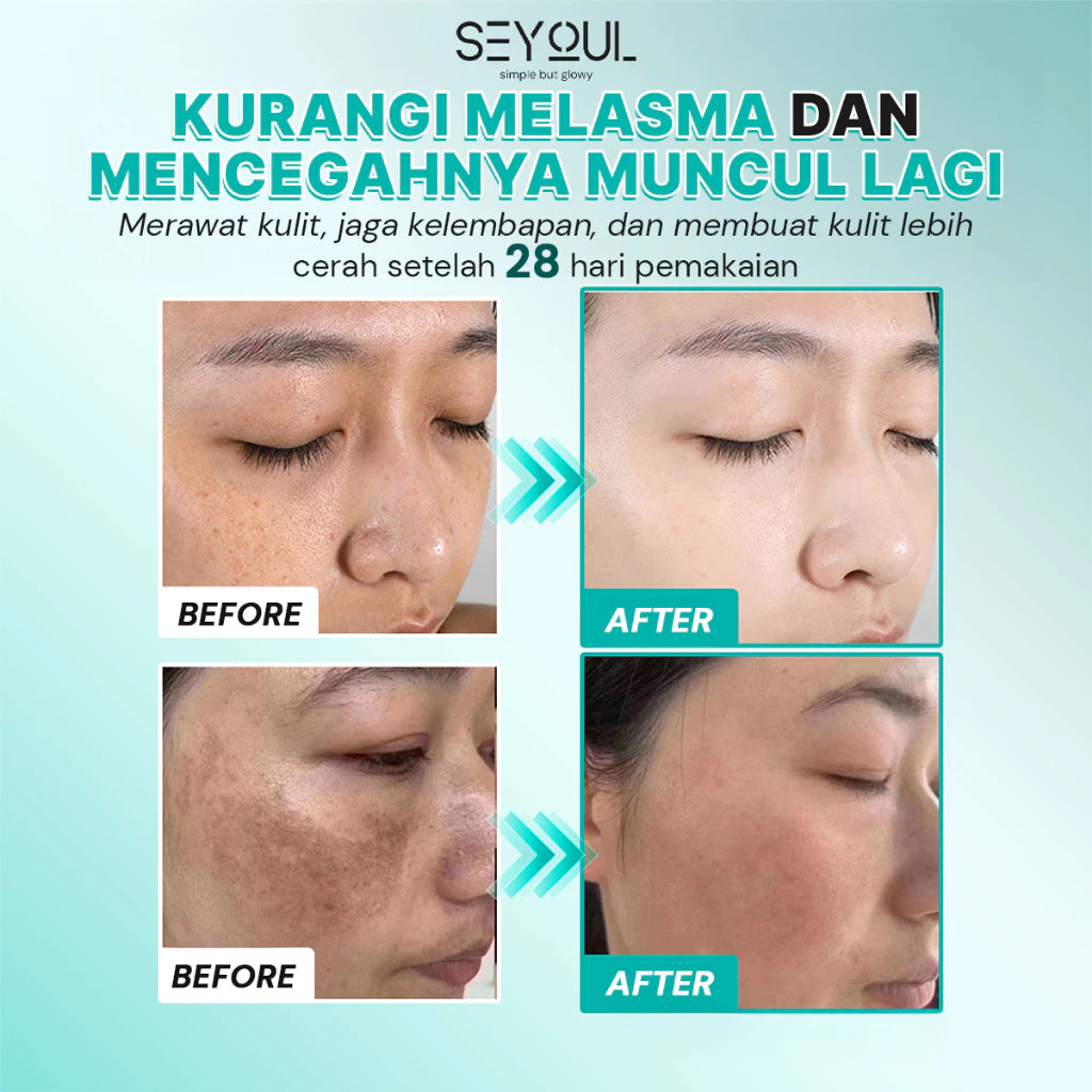 SEYOUL Advanced Serum 10% Niacinamide