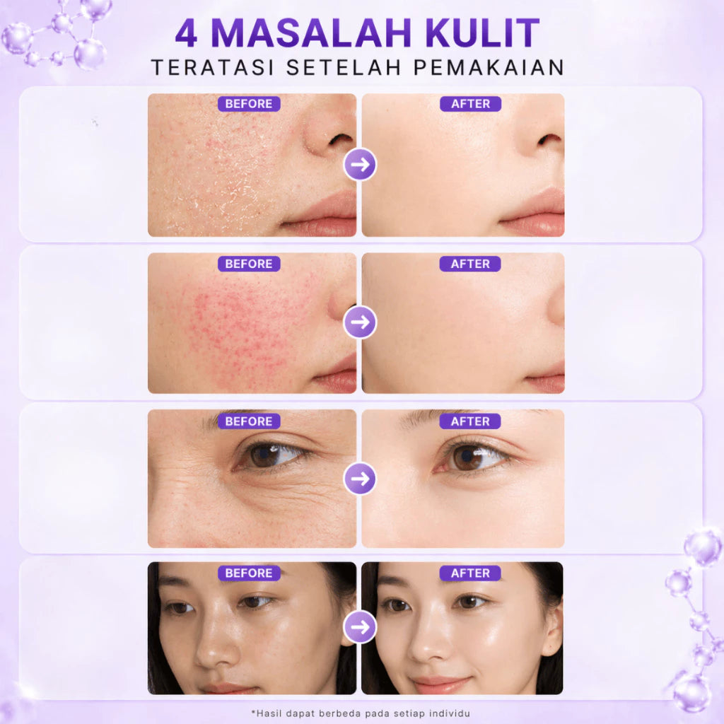 SEYU Melatonin Night Cream Time Renew Niacinamide